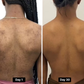 📢 Buy 1 Get 1 Free (2 PCS)🧼Authentic African Exfoliating Net Bath Sponge